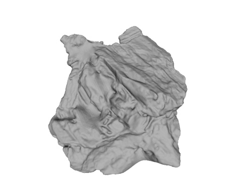 BIF-glomerate Rendering Image
