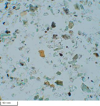 Smear slide of a sand layer.