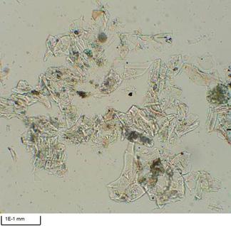 Smear slide of a volcanic ash layer.
