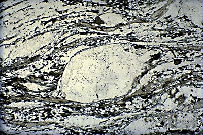 Sheared feldspar porphyroclasts