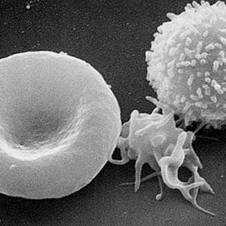 Hematology of Leukemia